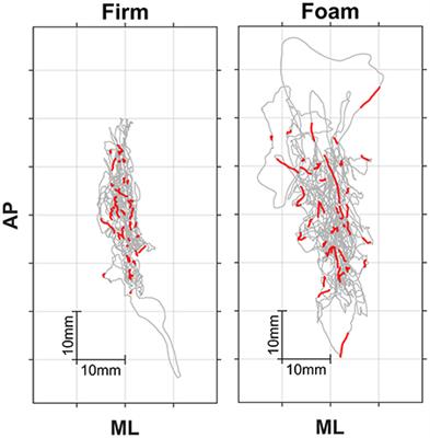 Unveiling Intermittency in the Control of Quiet Upright Standing: Beyond Automatic Behavior